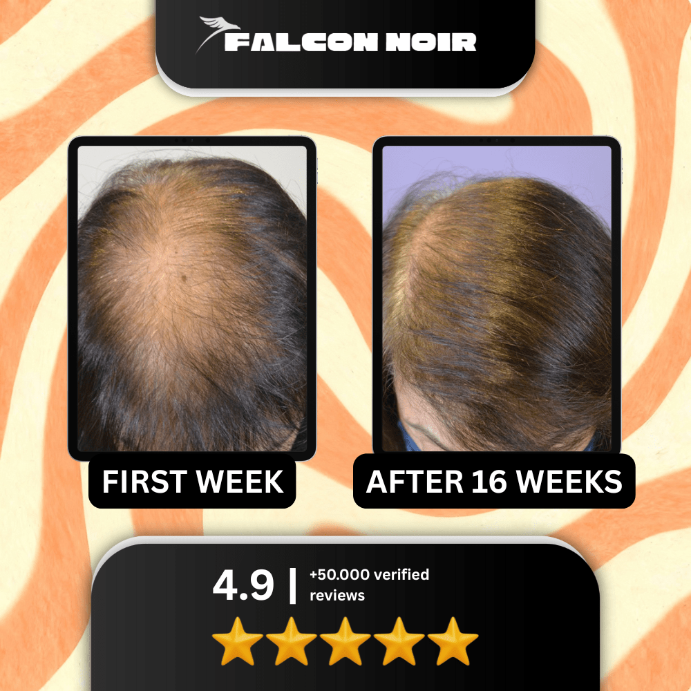 Falcon Noir™ Pumpkin Seed Oil Capsules for Women