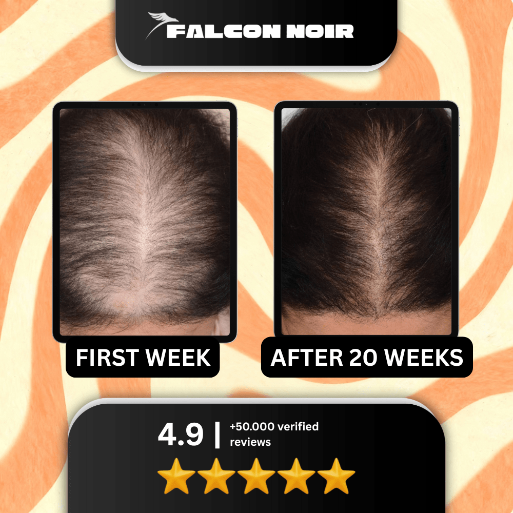 Falcon Noir™ Pumpkin Seed Oil Capsules for Women